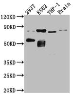 PKC theta Recombinant Rabbit Monoclonal Antibody (1B2)