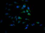 SAE1 Recombinant Rabbit Monoclonal Antibody (9D8)