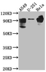 PDE4D Recombinant Rabbit Monoclonal Antibody (4D4)