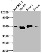 TIN2 Recombinant Rabbit Monoclonal Antibody (5G11)