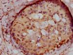 MNAR Antibody in Immunohistochemistry (Paraffin) (IHC (P))