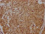 MNAR Recombinant Rabbit Monoclonal Antibody (6H4)