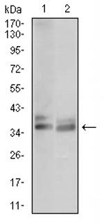 Tartrate Resistant Acid Phosphatase Monoclonal Antibody (5C5E7)