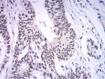 ASH2L Monoclonal Antibody (6F6B9)