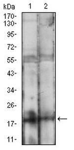 BAD Monoclonal Antibody (1G5B3)