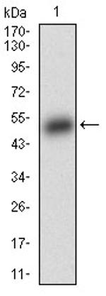 BAD Antibody in Western Blot (WB)