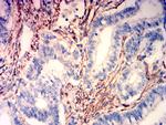 Caldesmon Antibody in Immunohistochemistry (Paraffin) (IHC (P))