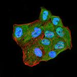 CBX2 Monoclonal Antibody (4C11B10)