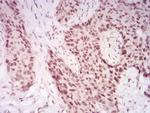 CBX2 Antibody in Immunohistochemistry (Paraffin) (IHC (P))