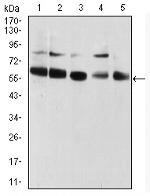 CBX2 Antibody in Western Blot (WB)