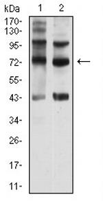 SEMA7A Monoclonal Antibody (1D5G8)