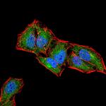 CD6 Monoclonal Antibody (5A10A2)