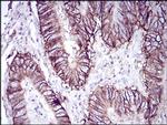 CDH17 Monoclonal Antibody (7D10E1)