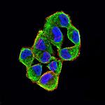 p16INK4a Monoclonal Antibody (4A10E1)