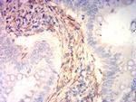 Calponin 3 Antibody in Immunohistochemistry (Paraffin) (IHC (P))