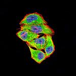 COL1A2 Monoclonal Antibody (4D1A7)