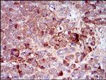 CSF1R Antibody in Immunohistochemistry (Paraffin) (IHC (P))