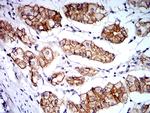 Catenin alpha-1 Antibody in Immunohistochemistry (Paraffin) (IHC (P))
