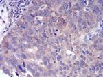 FGFR3 Antibody in Immunohistochemistry (Paraffin) (IHC (P))