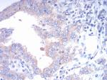FGFR3 Monoclonal Antibody (2H10B4)