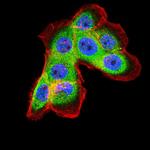 Ferritin Light Chain Antibody in Immunocytochemistry (ICC/IF)
