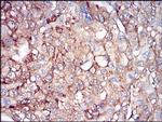 Ferritin Light Chain Antibody in Immunohistochemistry (Paraffin) (IHC (P))