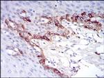 Ferritin Light Chain Antibody in Immunohistochemistry (Paraffin) (IHC (P))