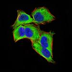 GLI1 Monoclonal Antibody (1B9F8)