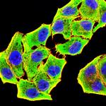 GSTP1 Monoclonal Antibody (1A7B5)