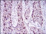HDAC10 Antibody in Immunohistochemistry (Paraffin) (IHC (P))