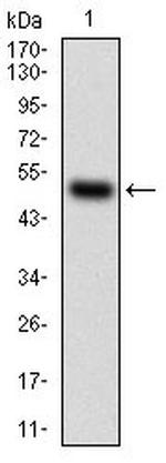 HDAC10 Antibody in Western Blot (WB)