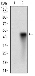 HDAC10 Antibody in Western Blot (WB)