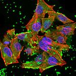 JARID2 Monoclonal Antibody (7H1B3)