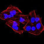 JMJD2A Antibody in Immunocytochemistry (ICC/IF)