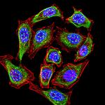 KMT2C Antibody in Immunocytochemistry (ICC/IF)