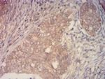 KMT2C Antibody in Immunohistochemistry (Paraffin) (IHC (P))