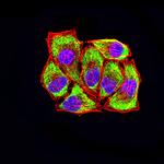 LRP3 Monoclonal Antibody (7B3A5E9)