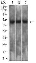 Mesothelin Monoclonal Antibody (7E6A6)