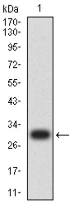 Mesothelin Antibody in Western Blot (WB)