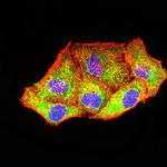 PCK2 Monoclonal Antibody (3D3D9)