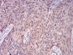 PLCG1 Antibody in Immunohistochemistry (Paraffin) (IHC (P))