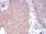 PLCG1 Antibody in Immunohistochemistry (Paraffin) (IHC (P))