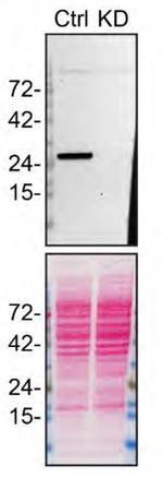 RAB27B Antibody in Western Blot (WB)