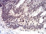 RAD50 Antibody in Immunohistochemistry (Paraffin) (IHC (P))