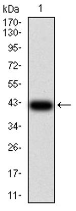 RAD50 Antibody in Western Blot (WB)