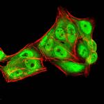 RAN Antibody in Immunocytochemistry (ICC/IF)