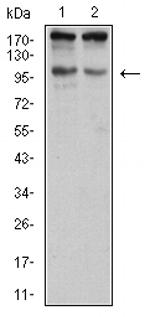 SALL4 Monoclonal Antibody (1A3E11)