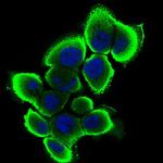 SERPINA7 Monoclonal Antibody (5B11E9)