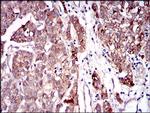 SERPINA7 Antibody in Immunohistochemistry (Paraffin) (IHC (P))