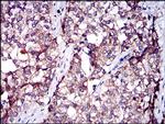 SERPINA7 Antibody in Immunohistochemistry (Paraffin) (IHC (P))